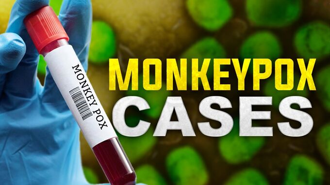 Monkeypox